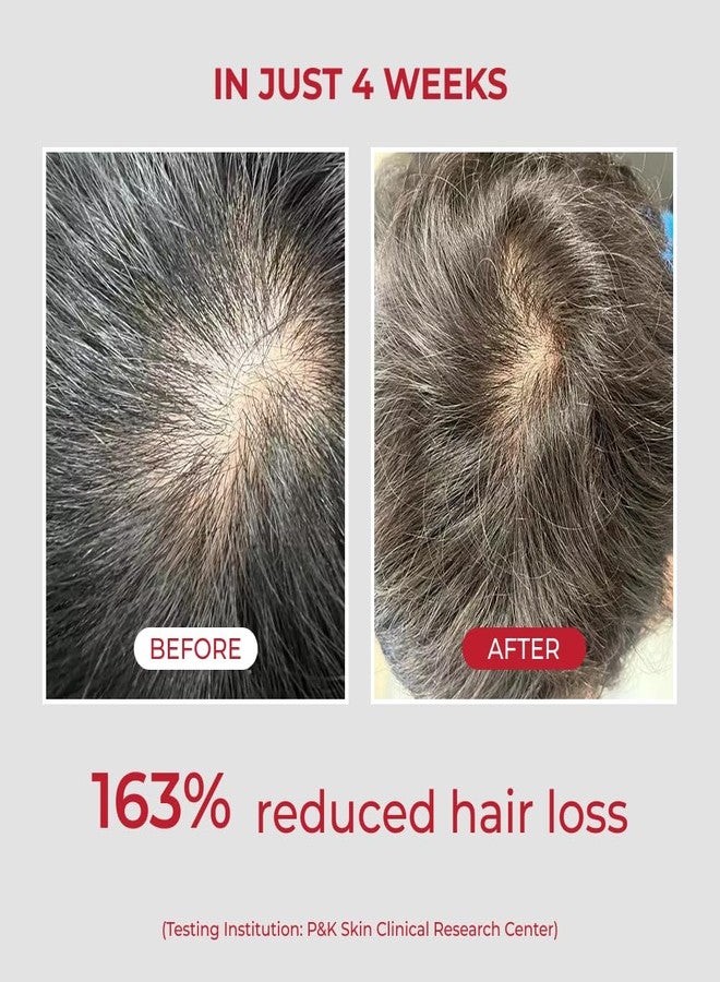MOEV ANNURCATIN Shampoo | Korean Apple Hair Care for Strength and Volume in Thinning Hair | Adds Lift | Paraben-Free | Suitable for All Hair Types (17.75 fl.oz, Apple & Vanilla) - Image 4